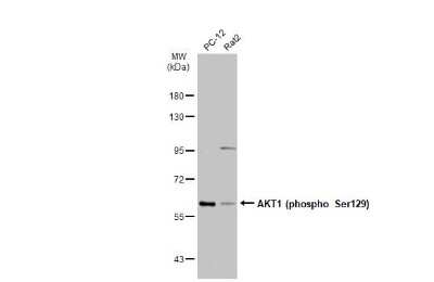 Western Blot: AKT1 [p Ser129] Antibody [NBP3-13418]